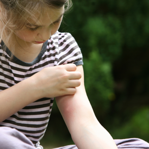 Child with mosquito bites